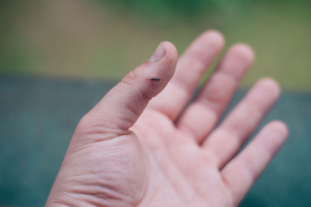 A wooden splinter in man's finger.
